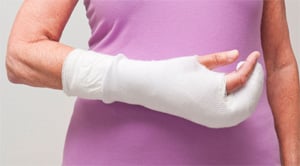 Arm in a cast