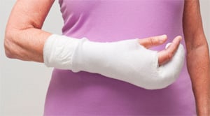 Arm in cast